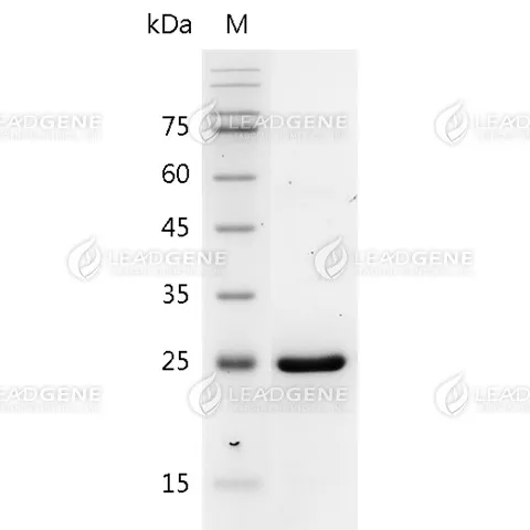 Human IL-30, His Tag, E. coli