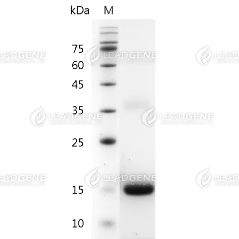 Human IL-31, His Tag, E. coli