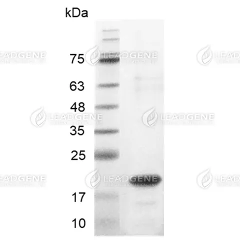 Human IL-33, His Tag, E. coli
