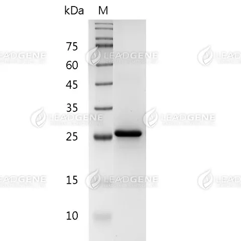 Human IL-34, His Tag, E. coli
