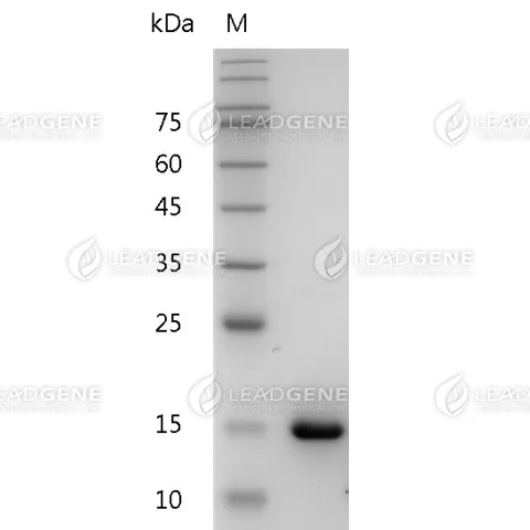 Human IL-36 Alpha, His Tag, E. coli