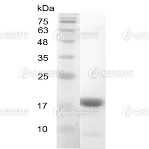 Human IL-36 Beta, His Tag, E. coli