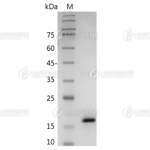 Human IL-36 Gamma, His Tag, E. coli
