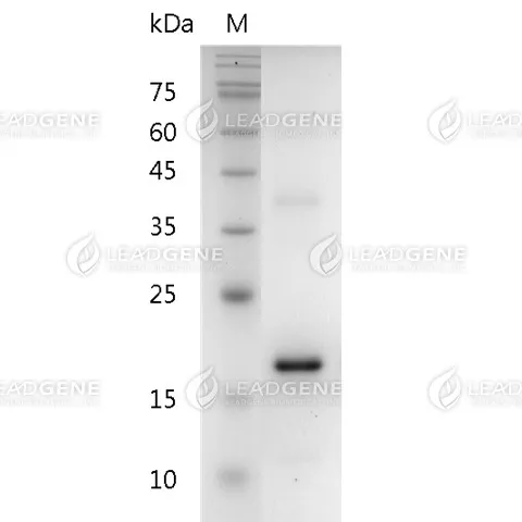 Human IL-37, His Tag, E. coli