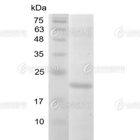 Human IL-38, His Tag, E. coli
