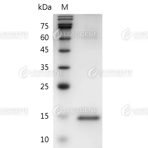 SDS-PAGE analysis of recombinant human GM-CSF.