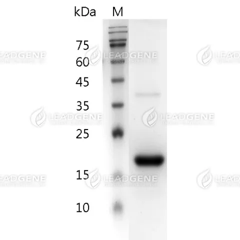SDS-PAGE analysis of recombinant Human IFN Beta 1b.