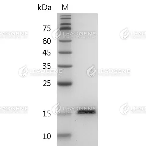 Human TNF Alpha, His Tag, E. coli