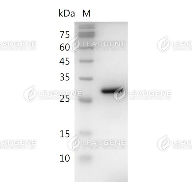 Human HMGB1, His Tag, E. coli