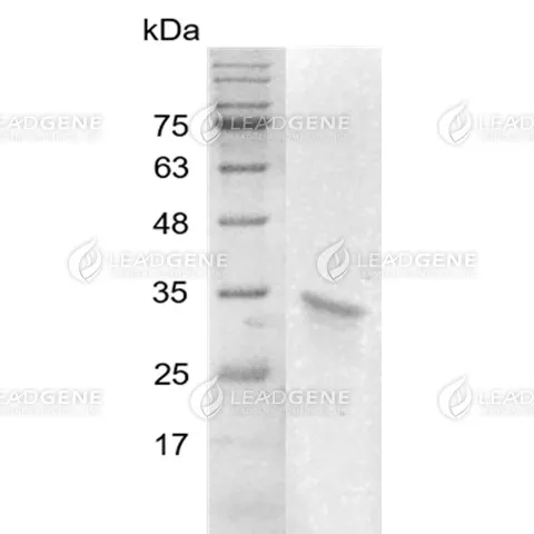 Human HMGB2, His Tag, E. coli