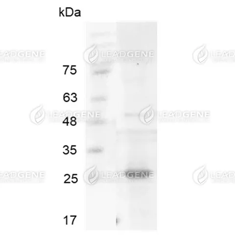 Human MMP7 (proenzyme), His Tag, E. coli