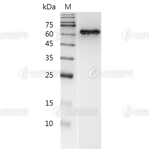 Human MMP2 (Active), His Tag, E. coli