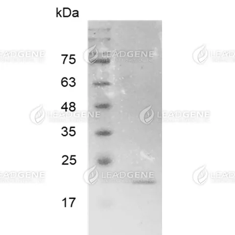 Human MMP7 (Active), His Tag, E. coli
