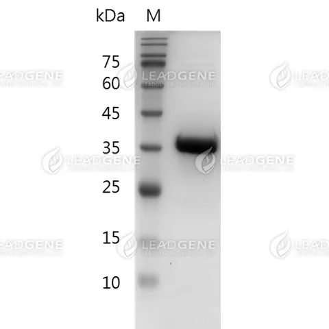 Human HDGF, His Tag, E. coli