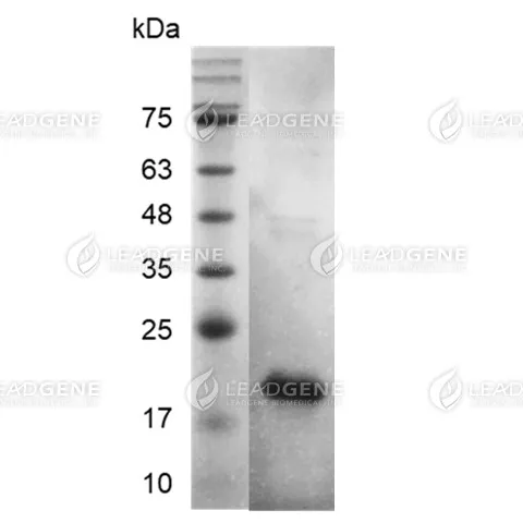 Human FGF-1, His Tag, E. coli