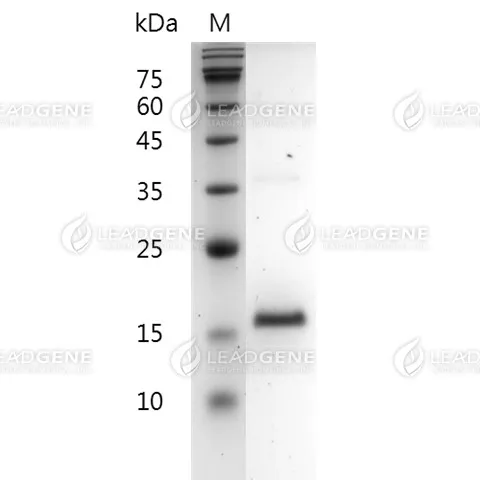 Human FGF-2 (aa 135-288), His Tag, E. coli