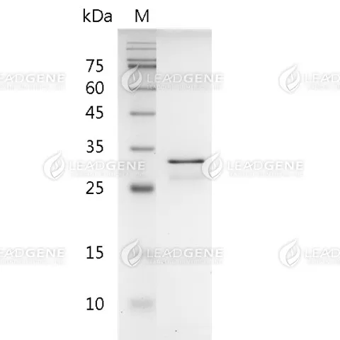 Human FGF-5, His Tag, E. coli