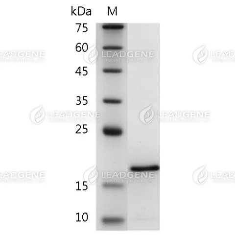 Human FGF-6, His Tag, E. coli