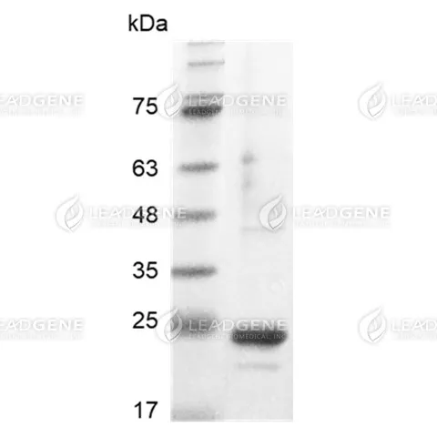Human FGF-9, His Tag, E. coli