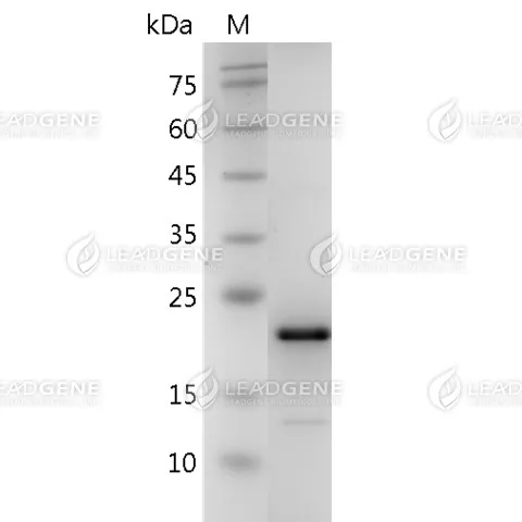 SDS-PAGE analysis of recombinant human FGF-12.