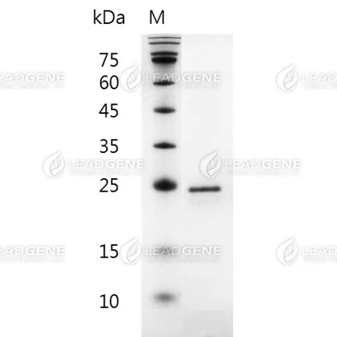 Human FGF-20, His Tag, E. coli