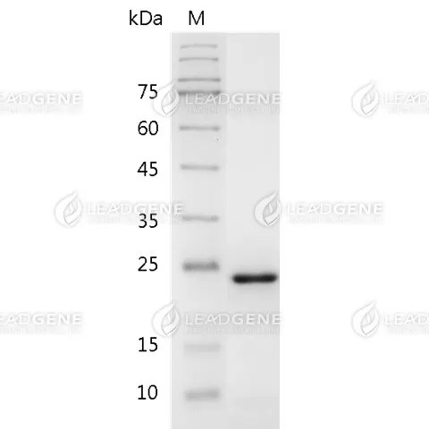 Human FGF-21, His Tag, E. coli
