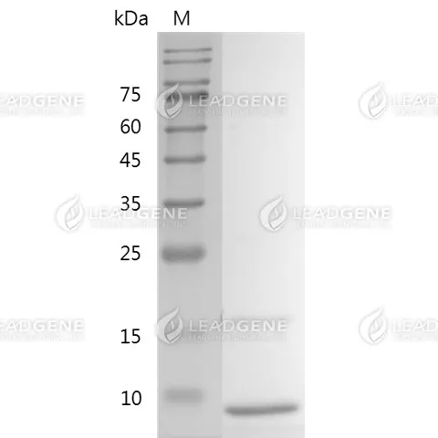 SDS-PAGE analysis of recombinant human IGF-I.