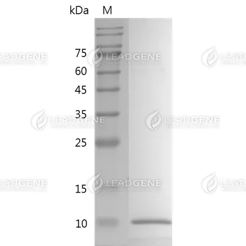 SDS-PAGE analysis of recombinant human IGF-II.