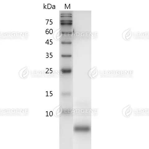 SDS-PAGE analysis of recombinant human TGF Alpha.