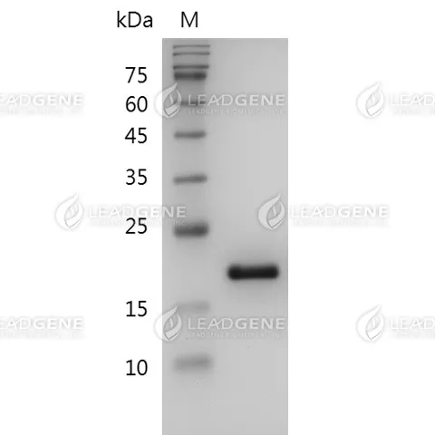 Human IL-1RA, His Tag, E. coli