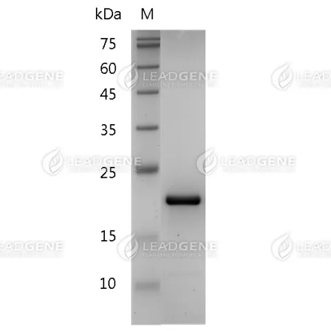 Human TNF Beta, His Tag, E. coli