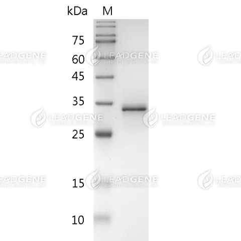 Human FASL, His-SUMO Tag, E. coli