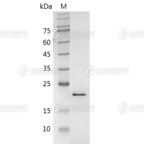 Human TL1A, His Tag, E. coli