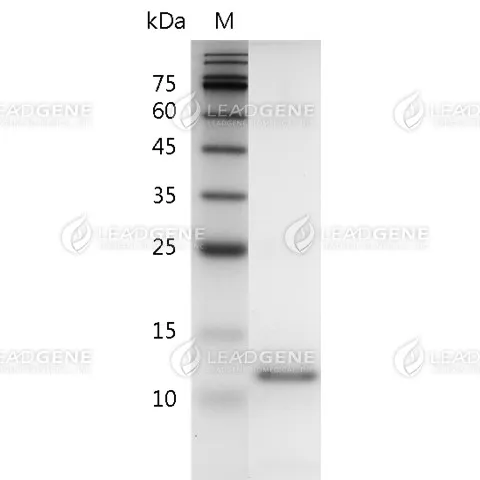 Human AITRL, His Tag, E. coli