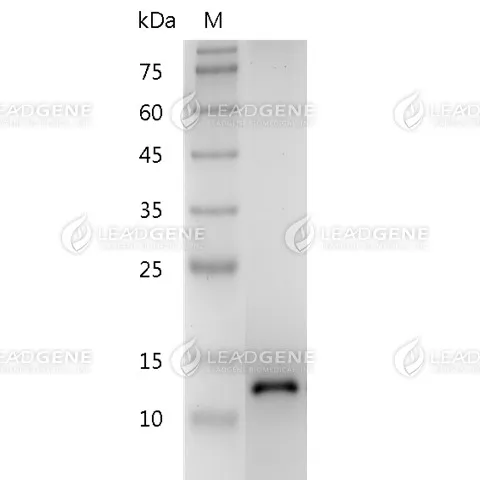 Human BDNF, His Tag, E. coli