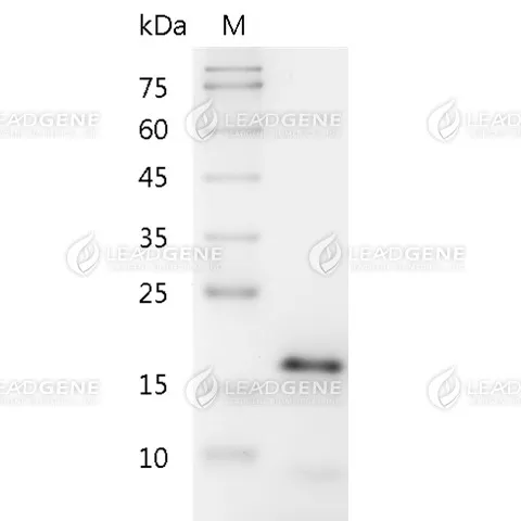 Human CDNF, His Tag, E. coli