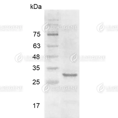SDS-PAGE analysis of recombinant human FGF-11 isoform 1.
