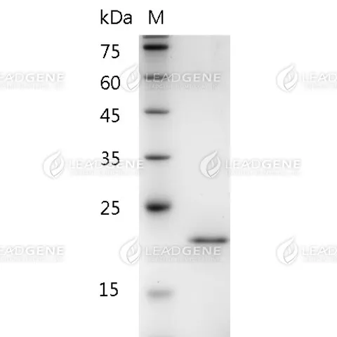SDS-PAGE analysis of recombinant human FGF-11 isoform 2.