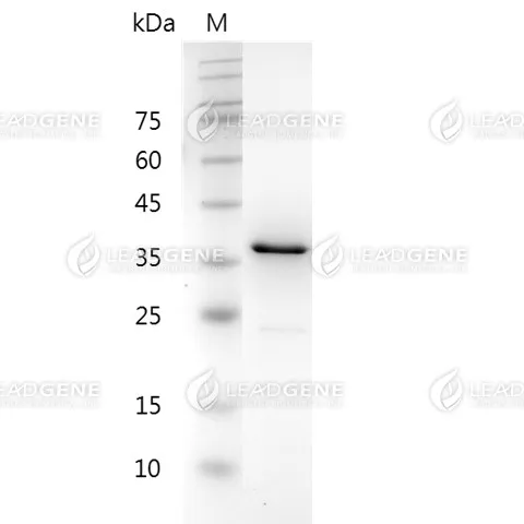 Human CHI3L1, His Tag, E. coli