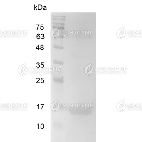 Human Galectin-2, His Tag, E. coli