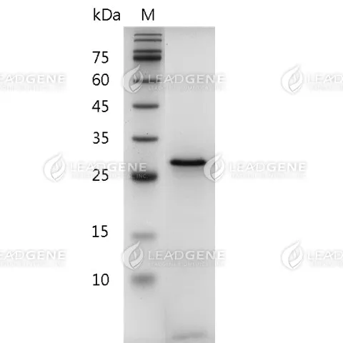 Human Galectin-3, His Tag, E. coli