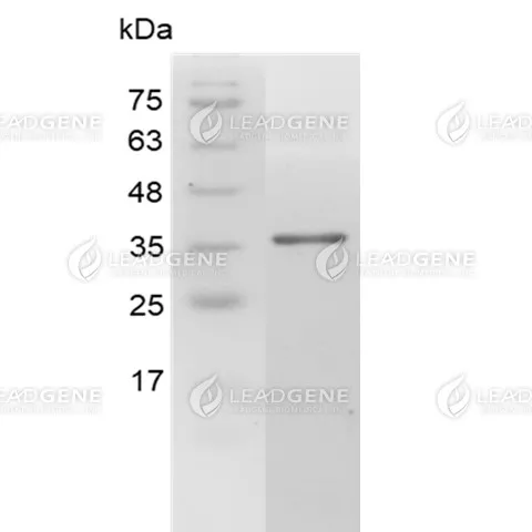 Human Galectin-4, His Tag, E. coli