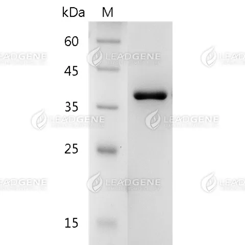 Human Galectin-8, His Tag, E. coli