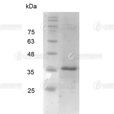 Human Galectin-9, His Tag, E. coli