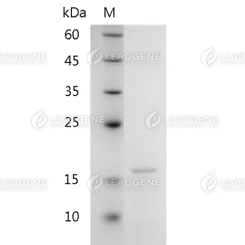 Human Galectin-10, His Tag, E. coli