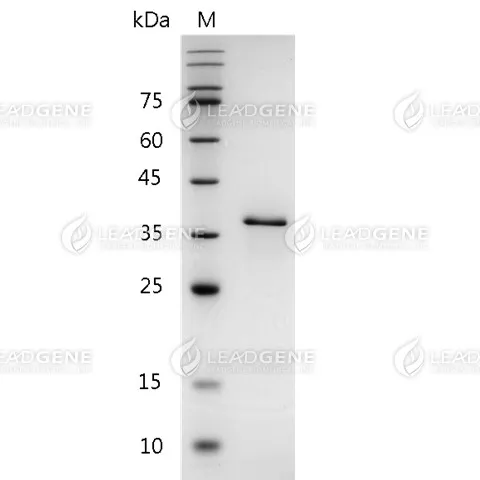 Human Galectin-12, His Tag, E. coli