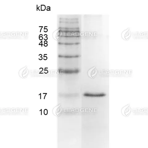 Human Galectin-14, His Tag, E. coli