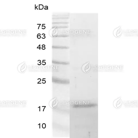 Human Galectin-16, His Tag, E. coli