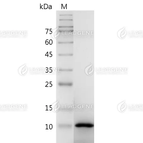 Human CXCL2, His Tag, E. coli