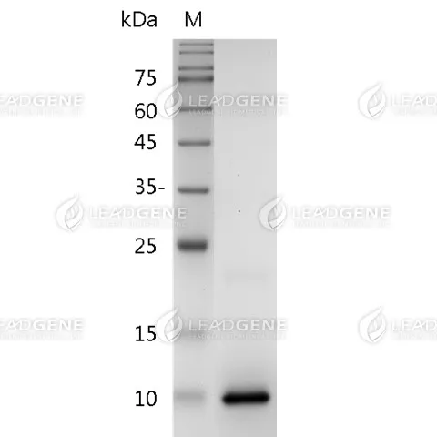 SDS-PAGE analysis of recombinant human CXCL4.